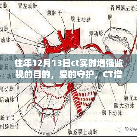 愛(ài)的守護(hù)，CT增強(qiáng)監(jiān)視下的暖心故事與實(shí)時(shí)增強(qiáng)監(jiān)視目的揭秘