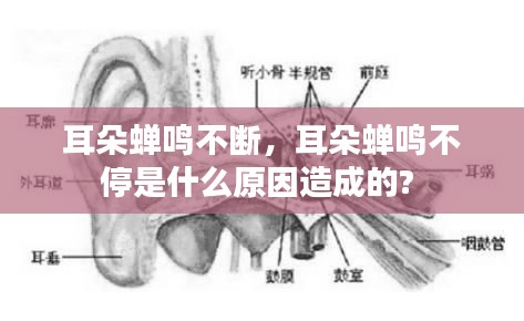 耳朵蟬鳴不斷，耳朵蟬鳴不停是什么原因造成的? 