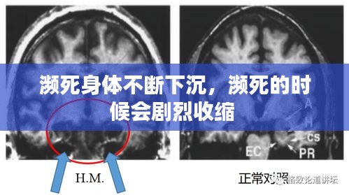 瀕死身體不斷下沉，瀕死的時候會劇烈收縮 