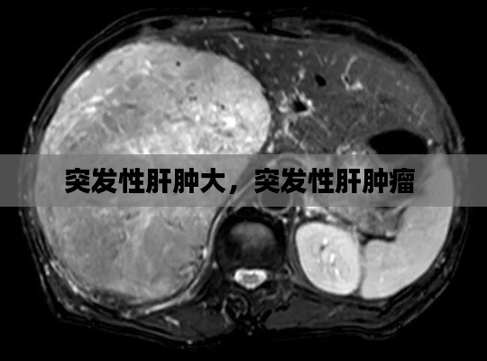 突發(fā)性肝腫大，突發(fā)性肝腫瘤 