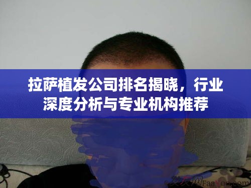 拉薩植發(fā)公司排名揭曉，行業(yè)深度分析與專業(yè)機構推薦